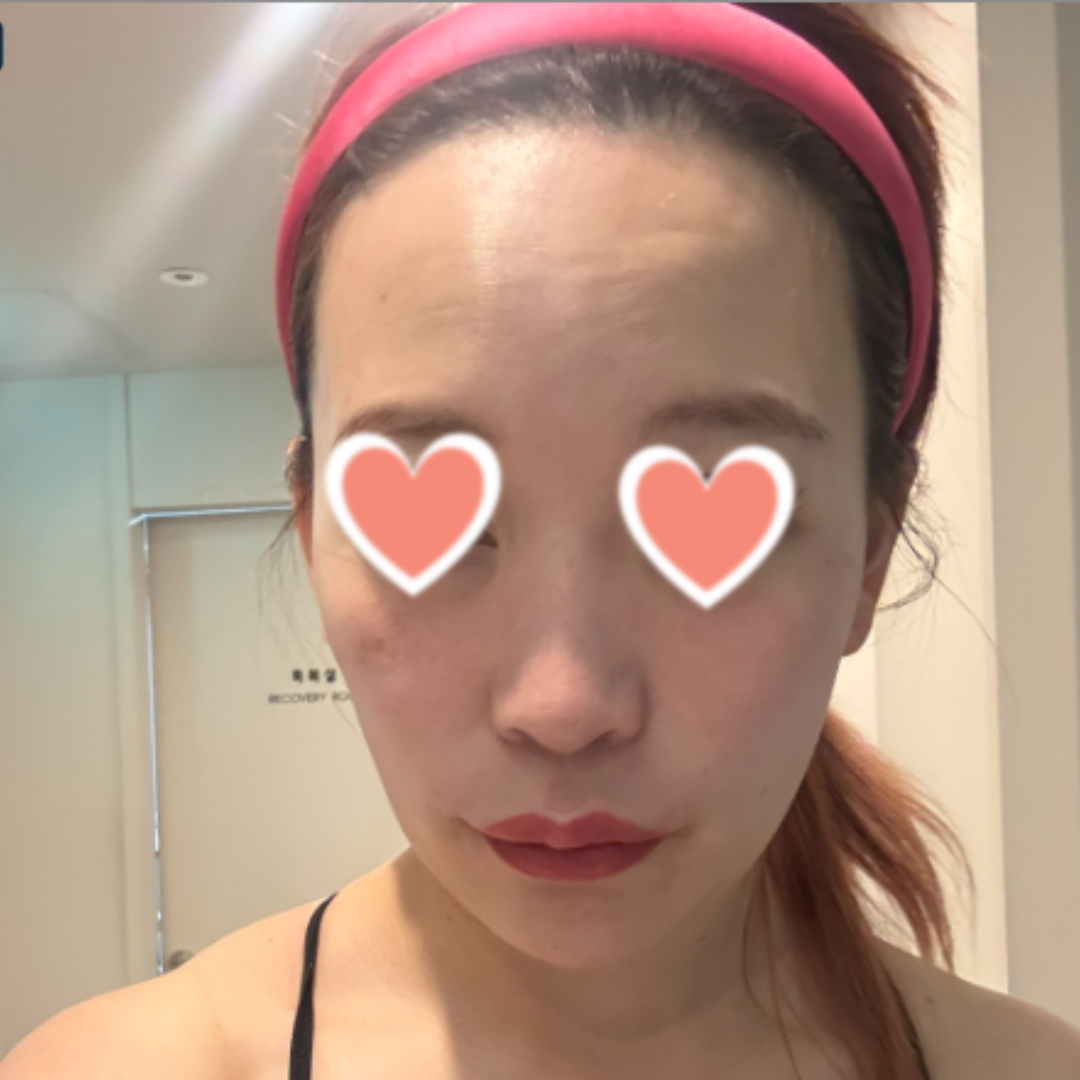 수술후기이미지