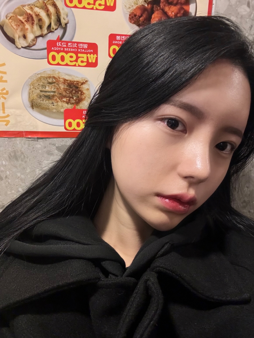 수술후기이미지