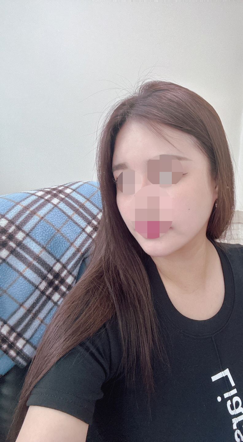 수술후기이미지