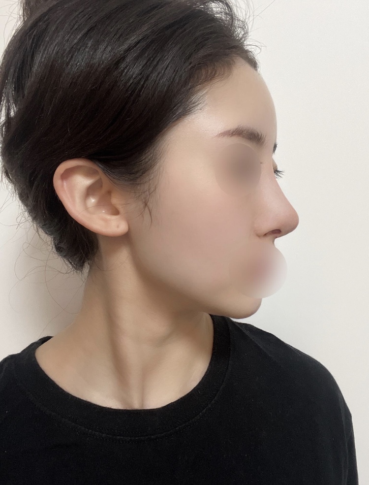 수술후기이미지