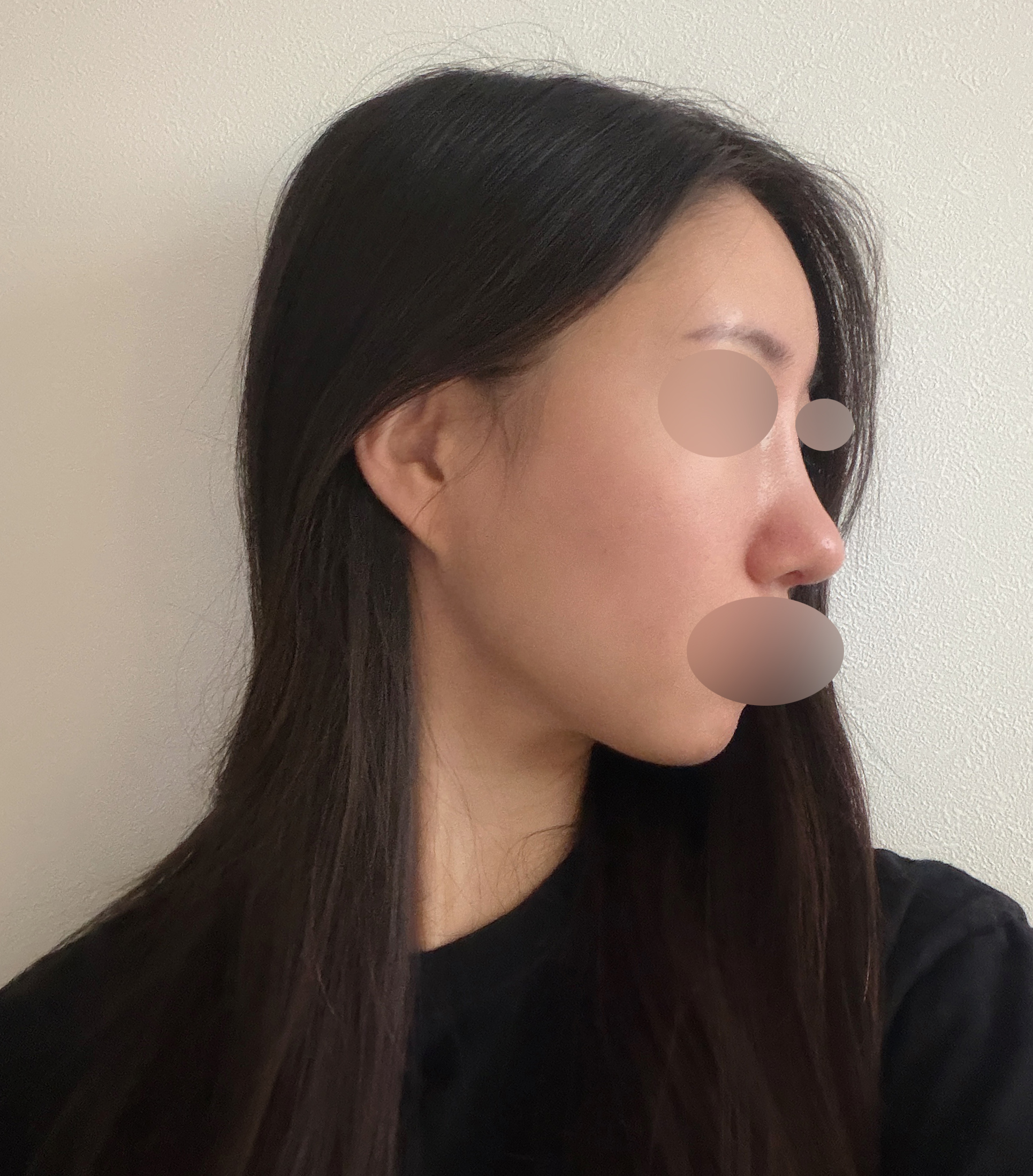 수술후기이미지