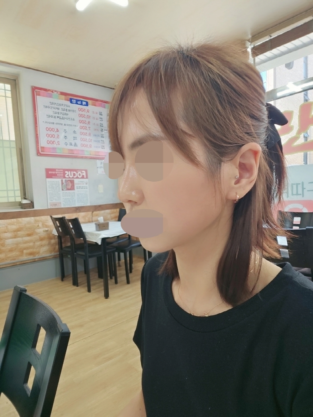 수술후기이미지