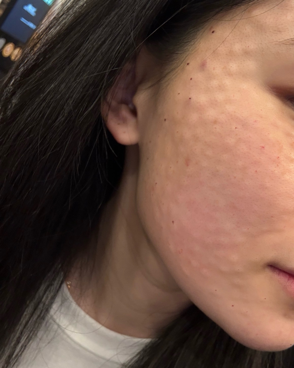 수술후기이미지