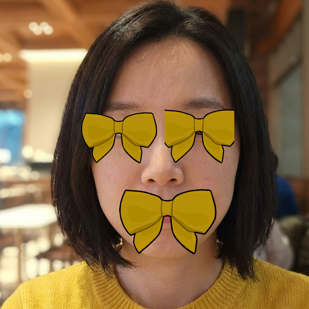 수술후기이미지