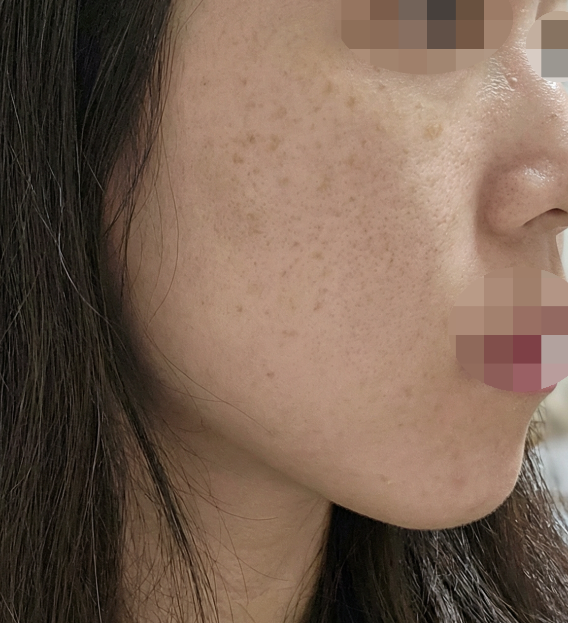 수술후기이미지