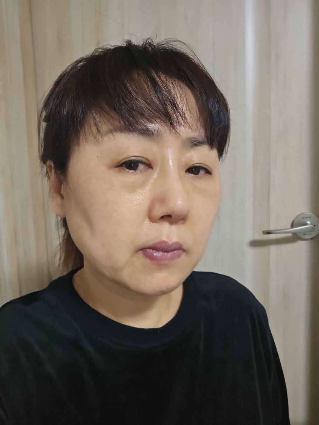 수술후기이미지