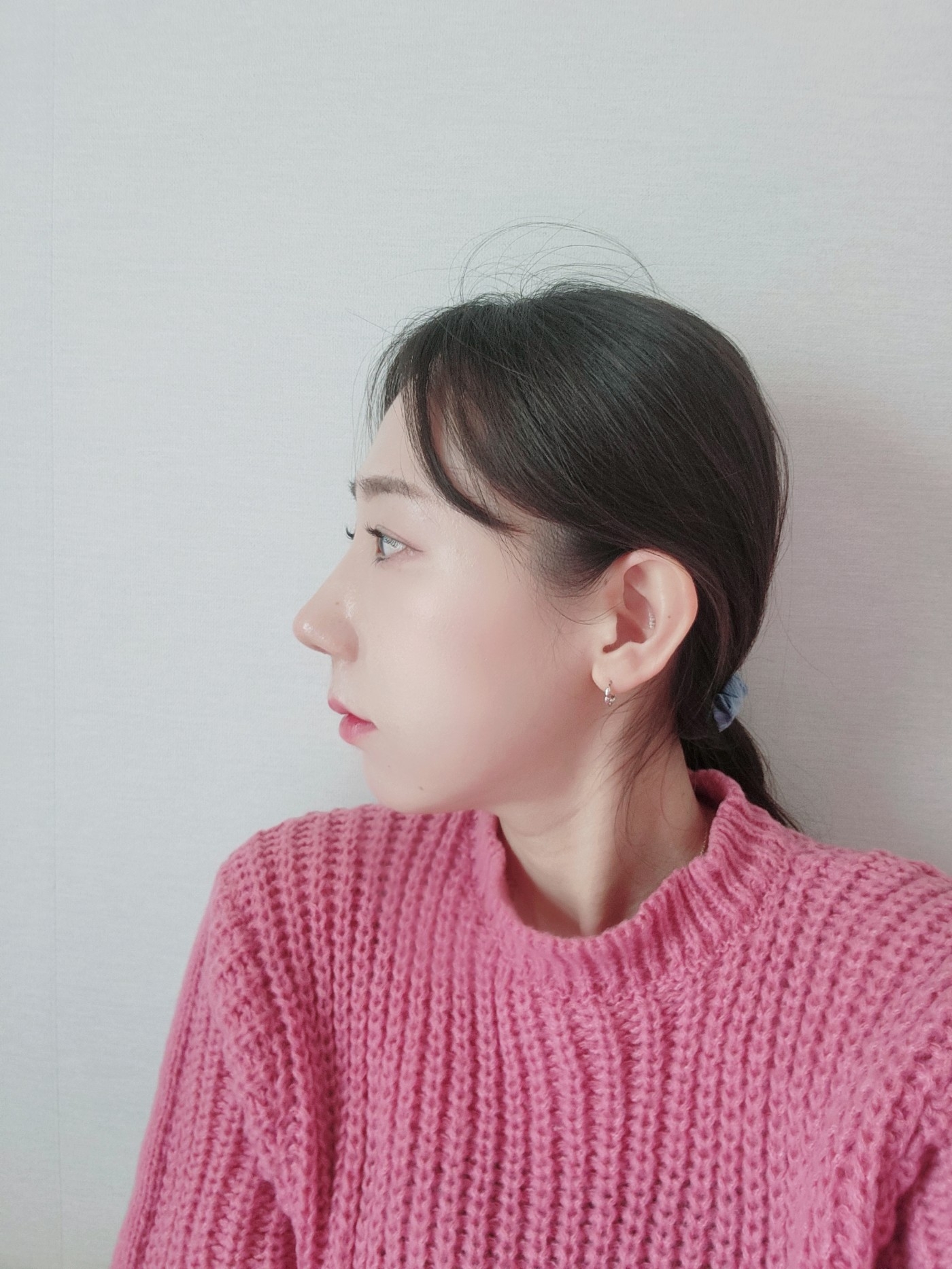 수술후기이미지