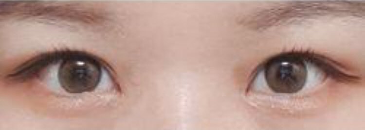 수술후기이미지