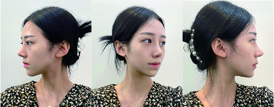 수술후기이미지