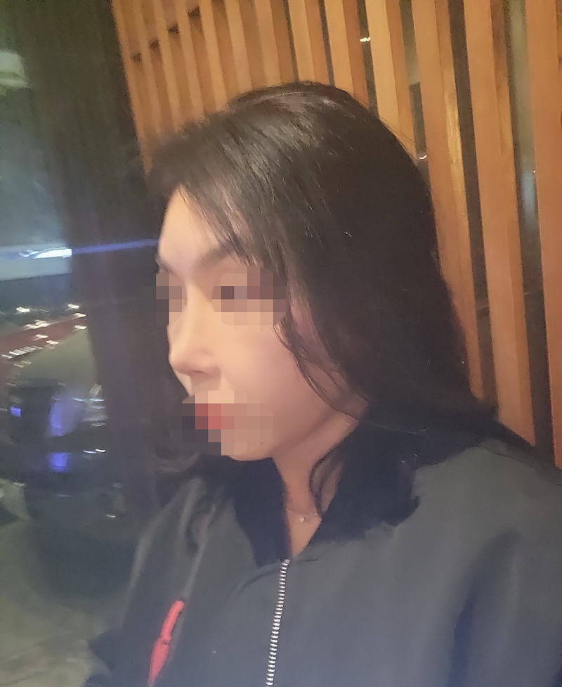 수술후기이미지