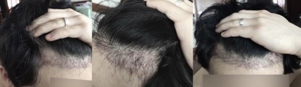 수술후기이미지