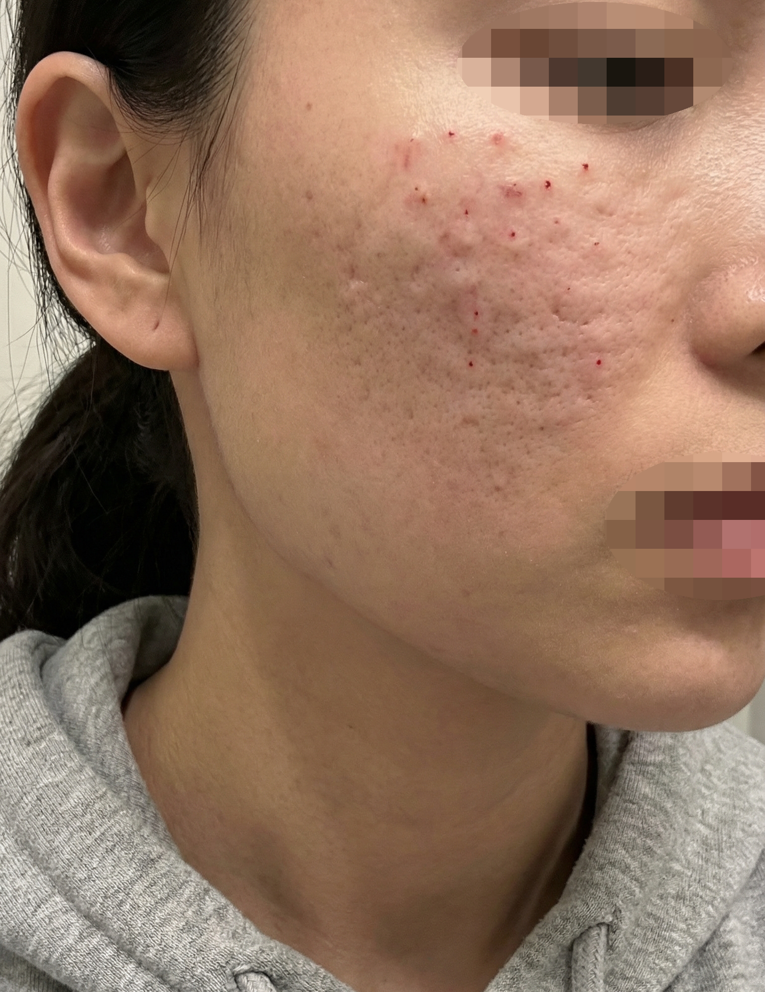 수술후기이미지