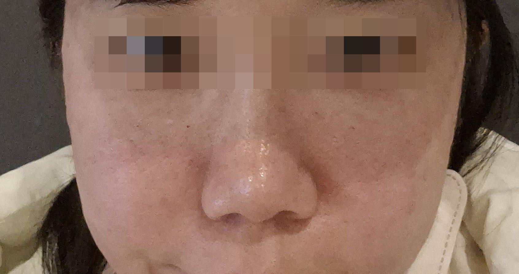 수술후기이미지