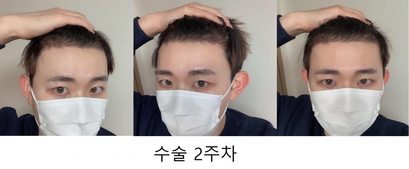 수술후기이미지