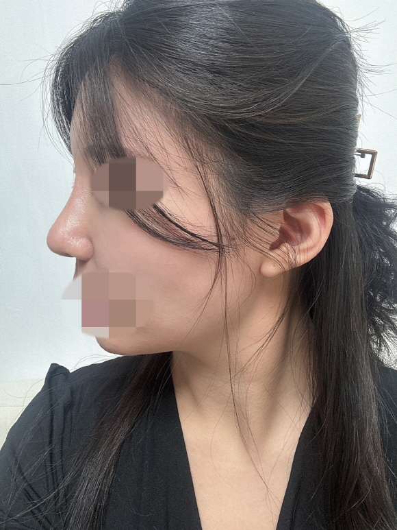 수술후기이미지