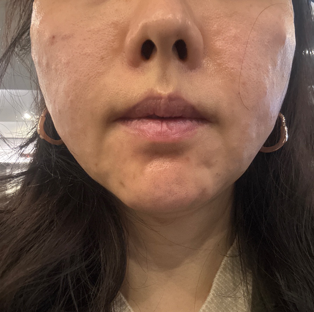 수술후기이미지