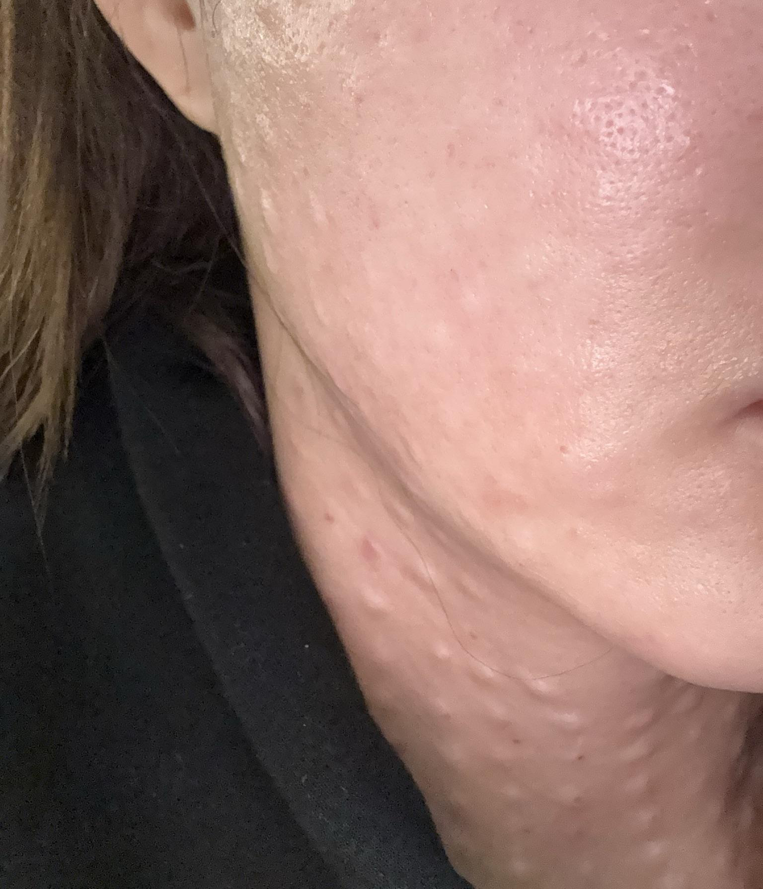 수술후기이미지