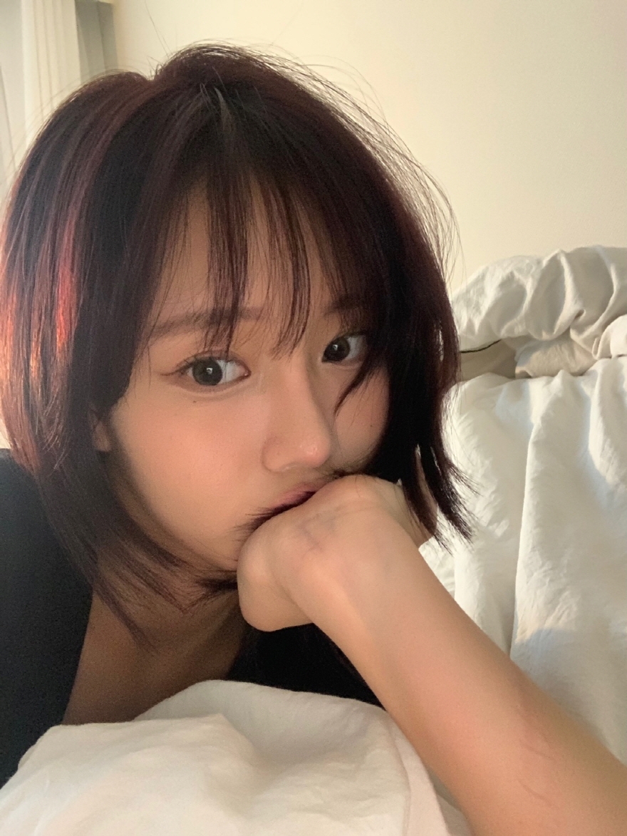 수술후기이미지