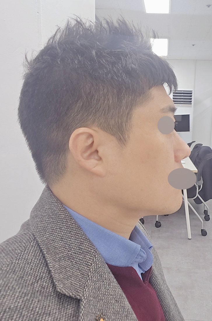 수술후기이미지