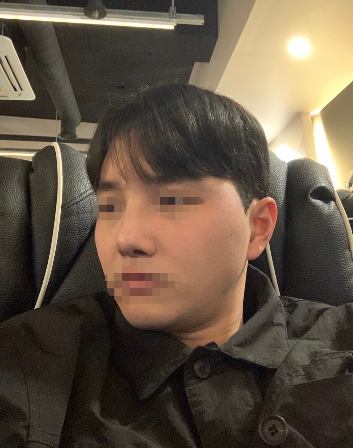 수술후기이미지