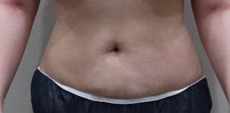 수술후기이미지