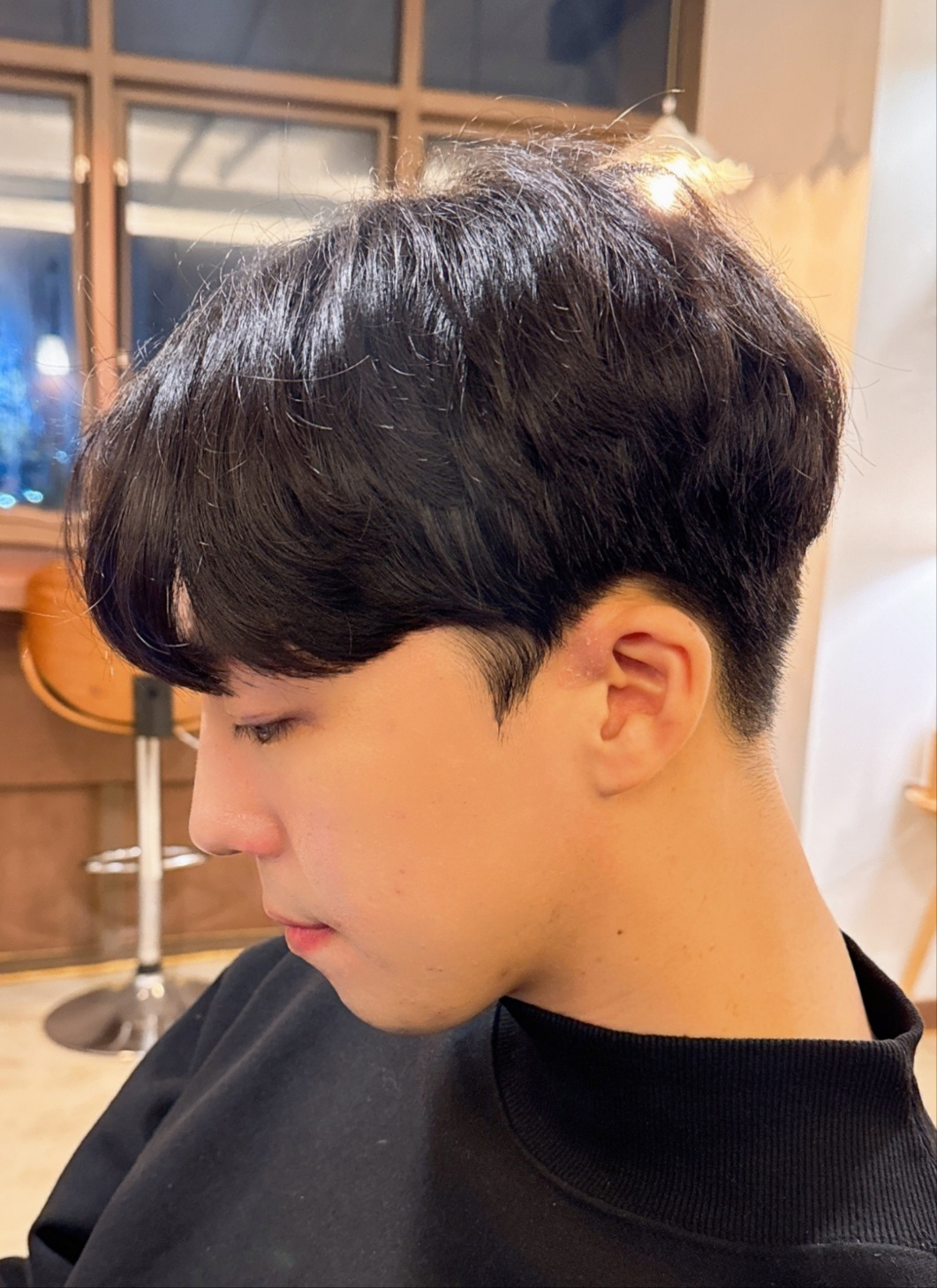 수술후기이미지