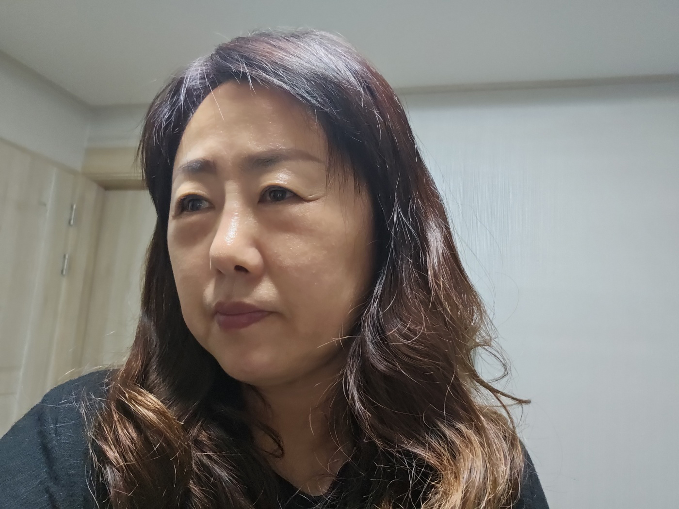 수술후기이미지