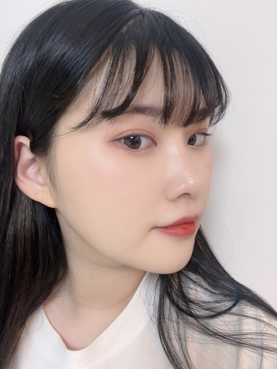 수술후기이미지