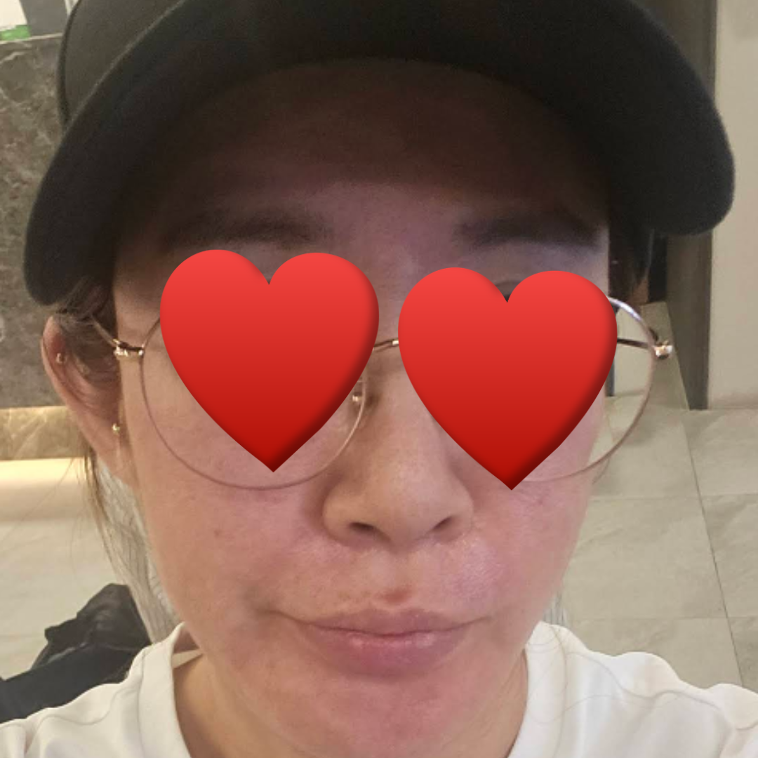 수술후기이미지