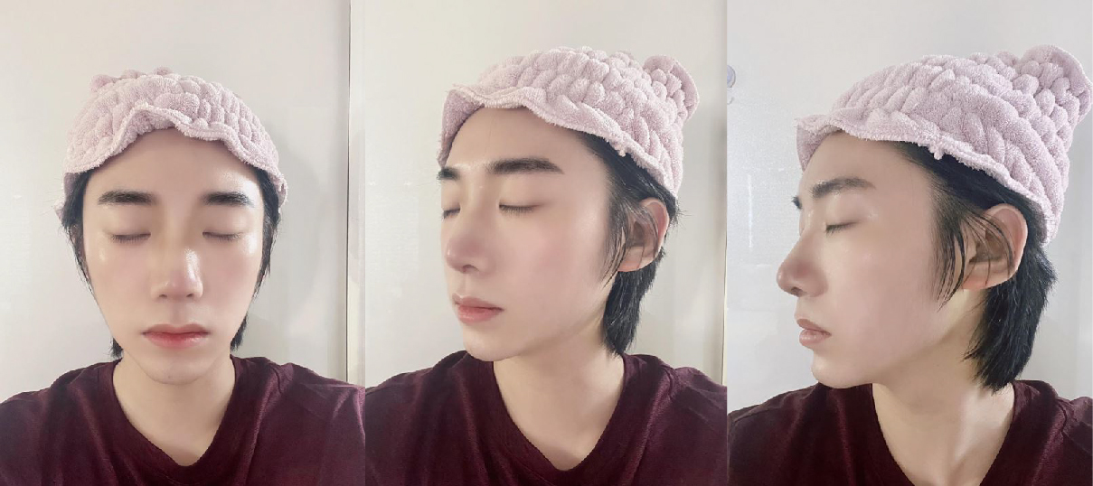 수술후기이미지