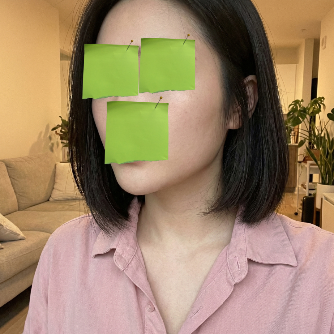 수술후기이미지