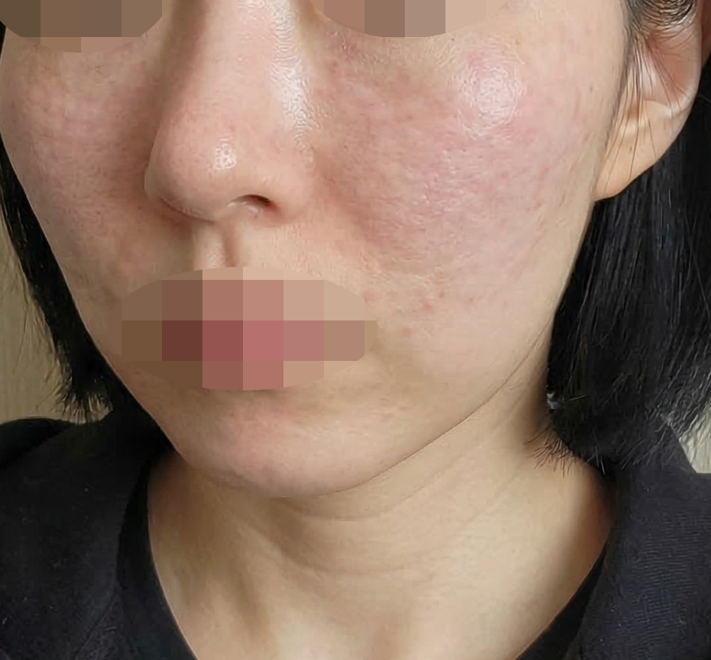 수술후기이미지