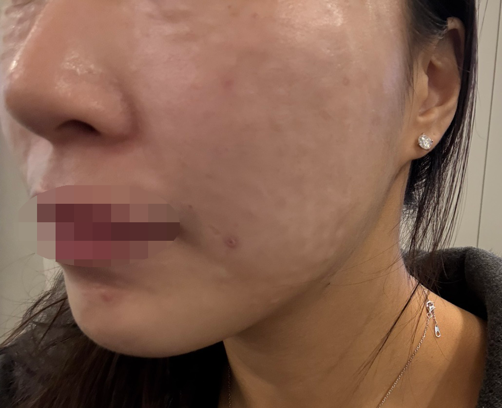 수술후기이미지