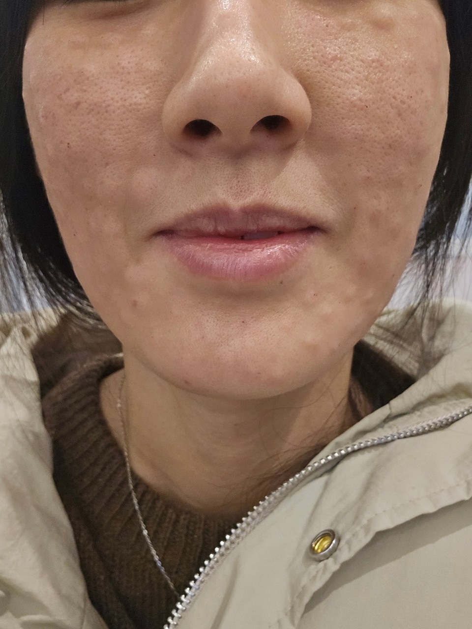 수술후기이미지