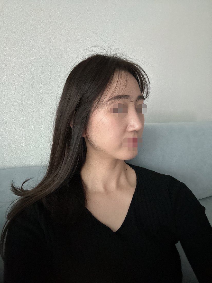 수술후기이미지