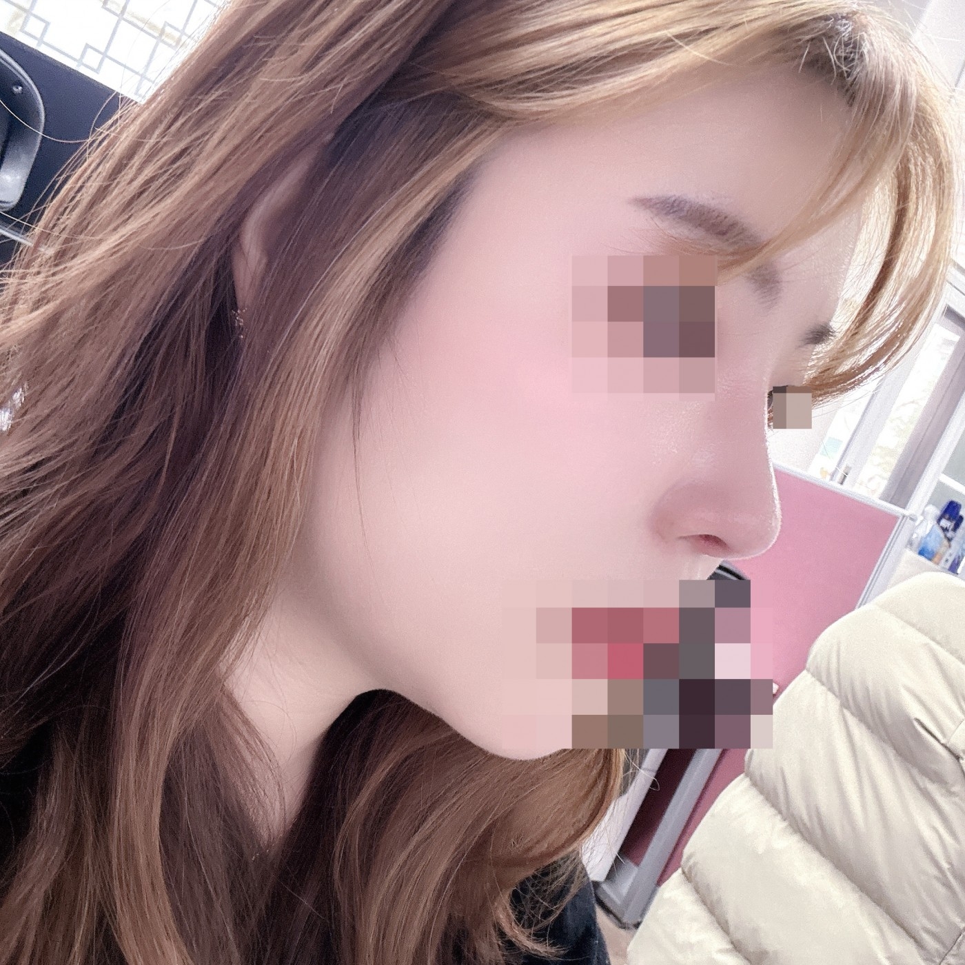 수술후기이미지