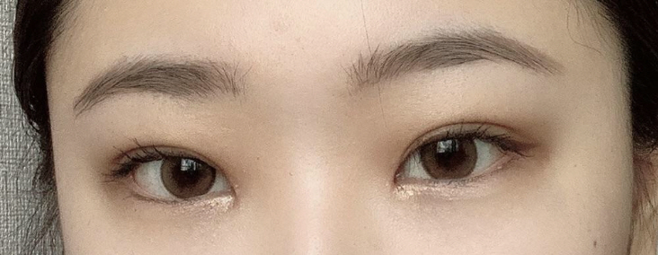 수술후기이미지