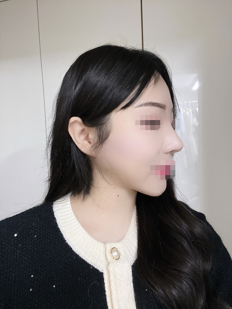 수술후기이미지