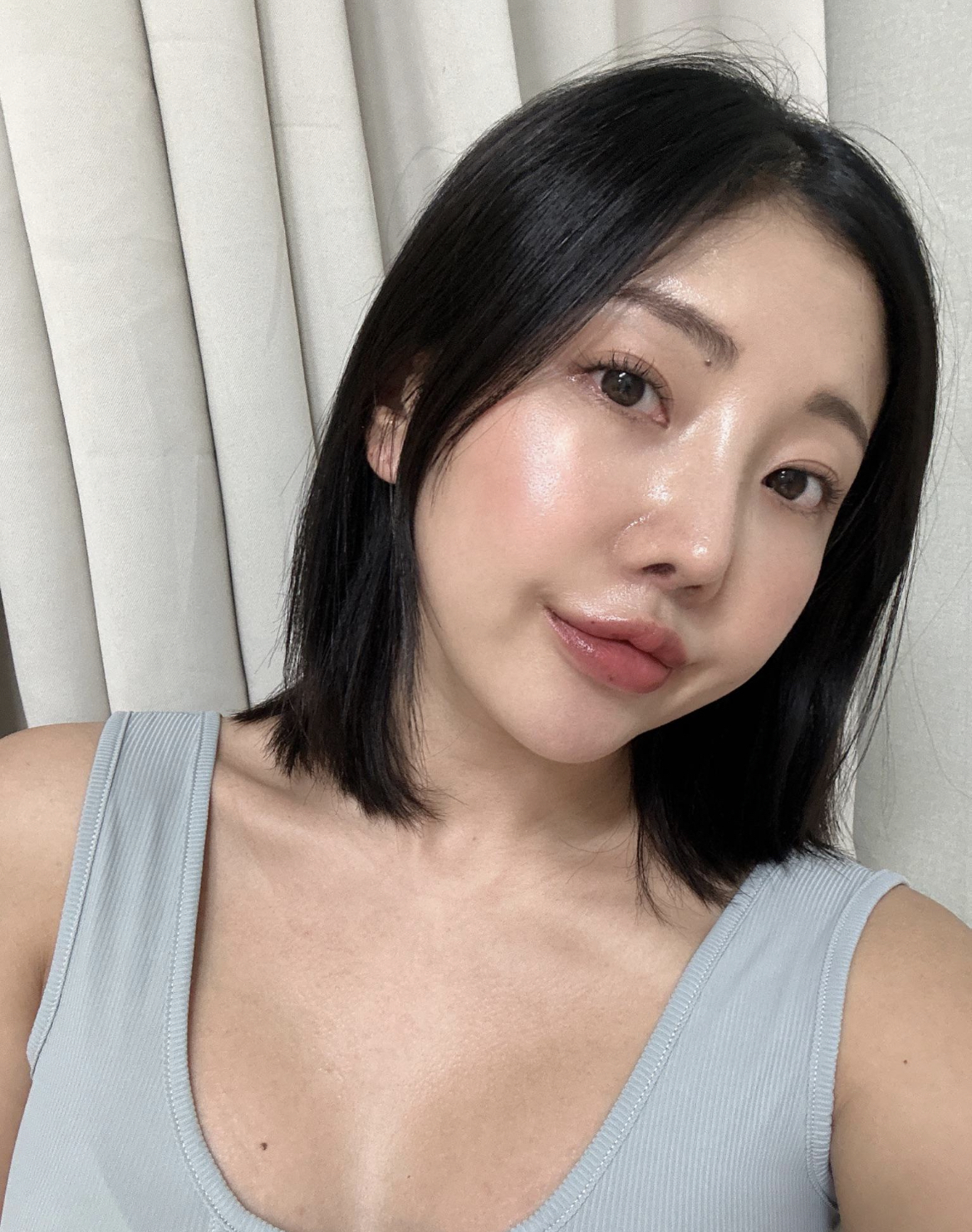 수술후기이미지