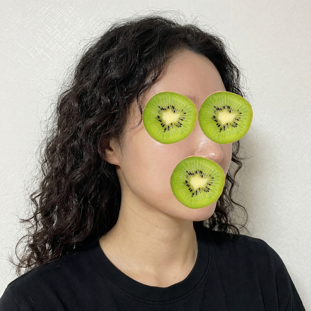 수술후기이미지