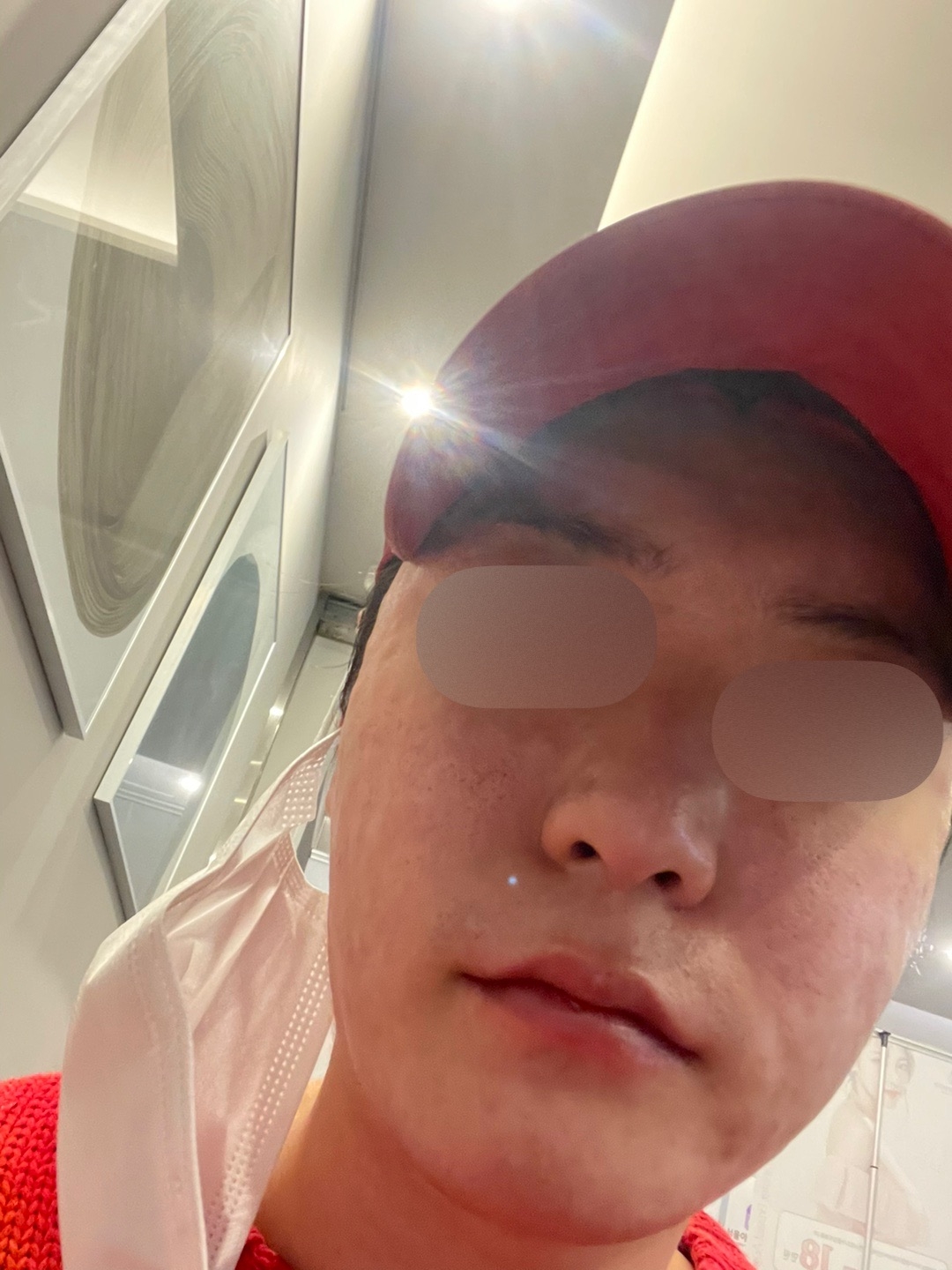 수술후기이미지