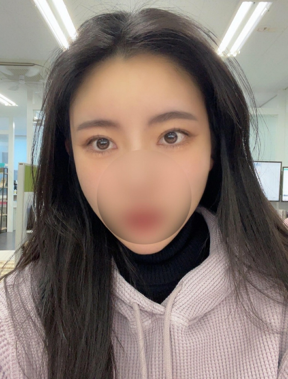 수술후기이미지