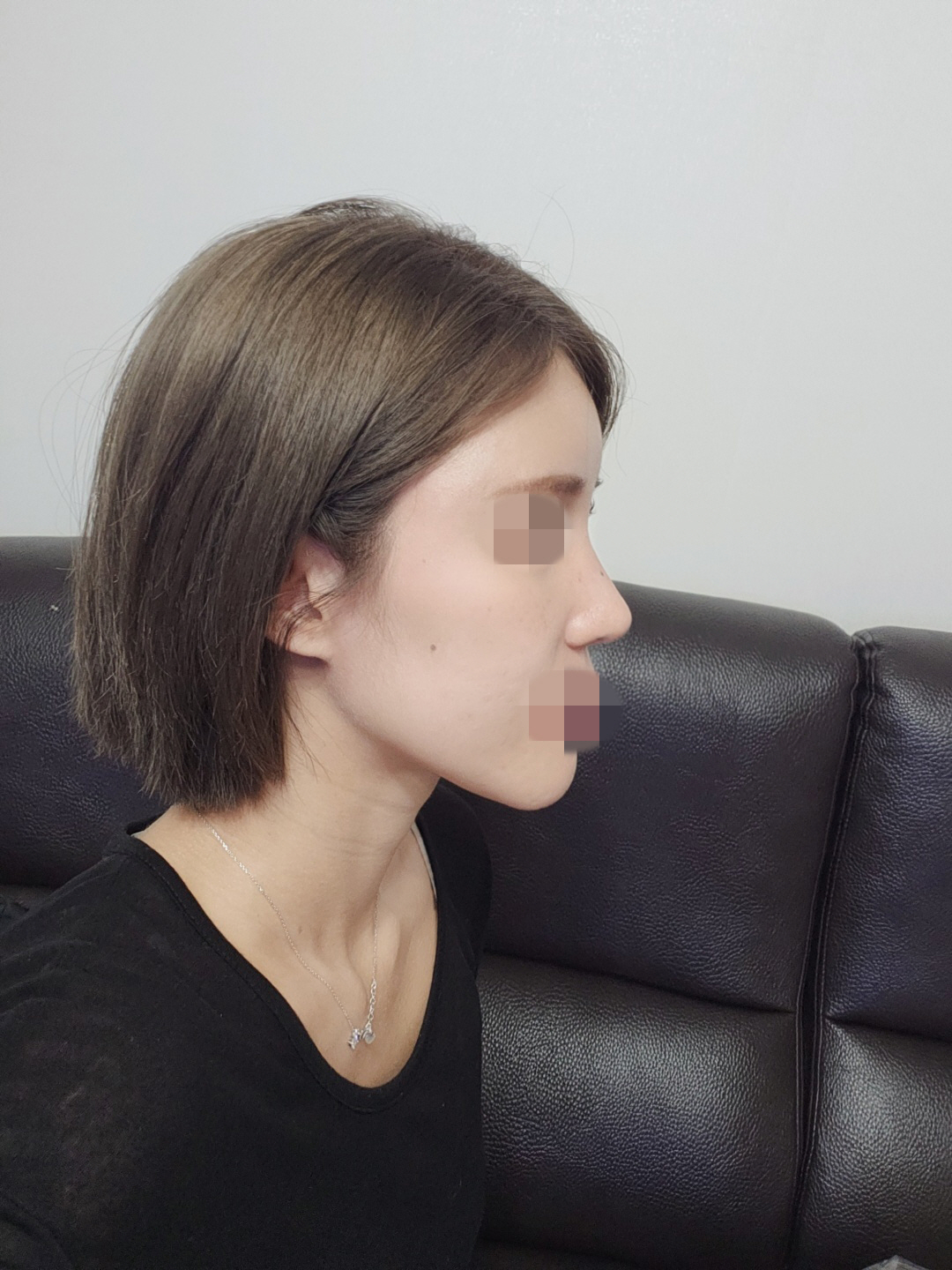 수술후기이미지