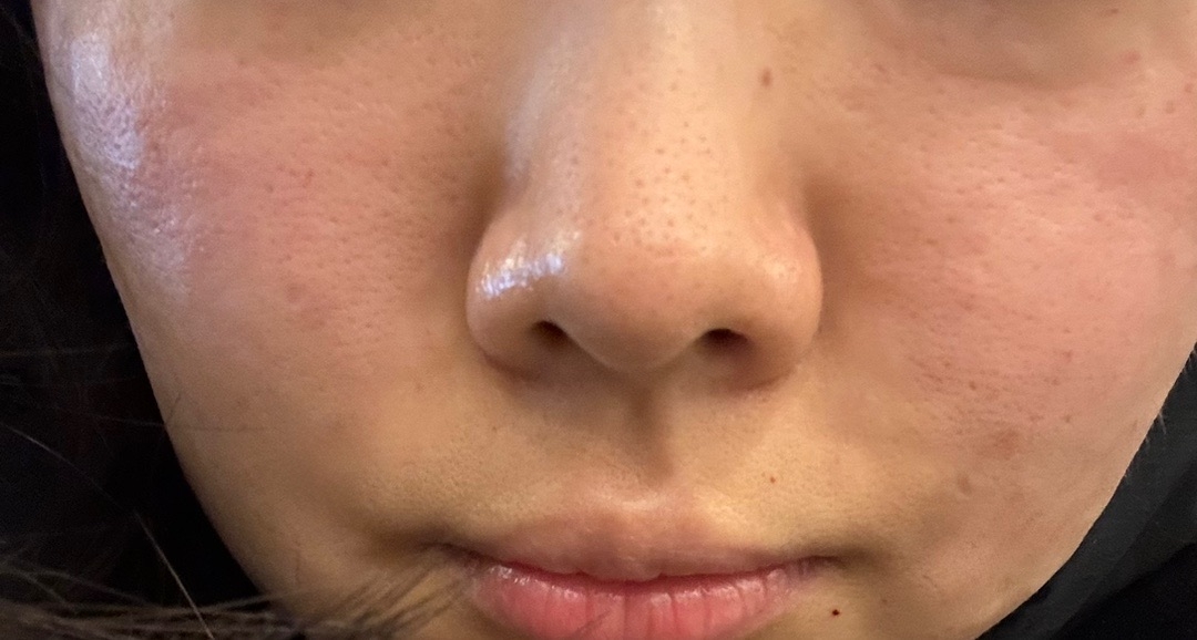 수술후기이미지