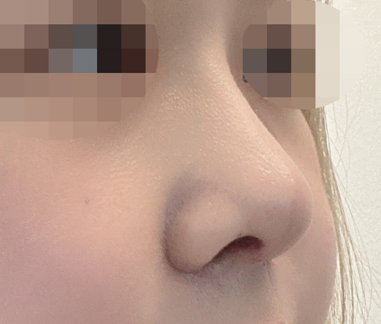 수술후기이미지