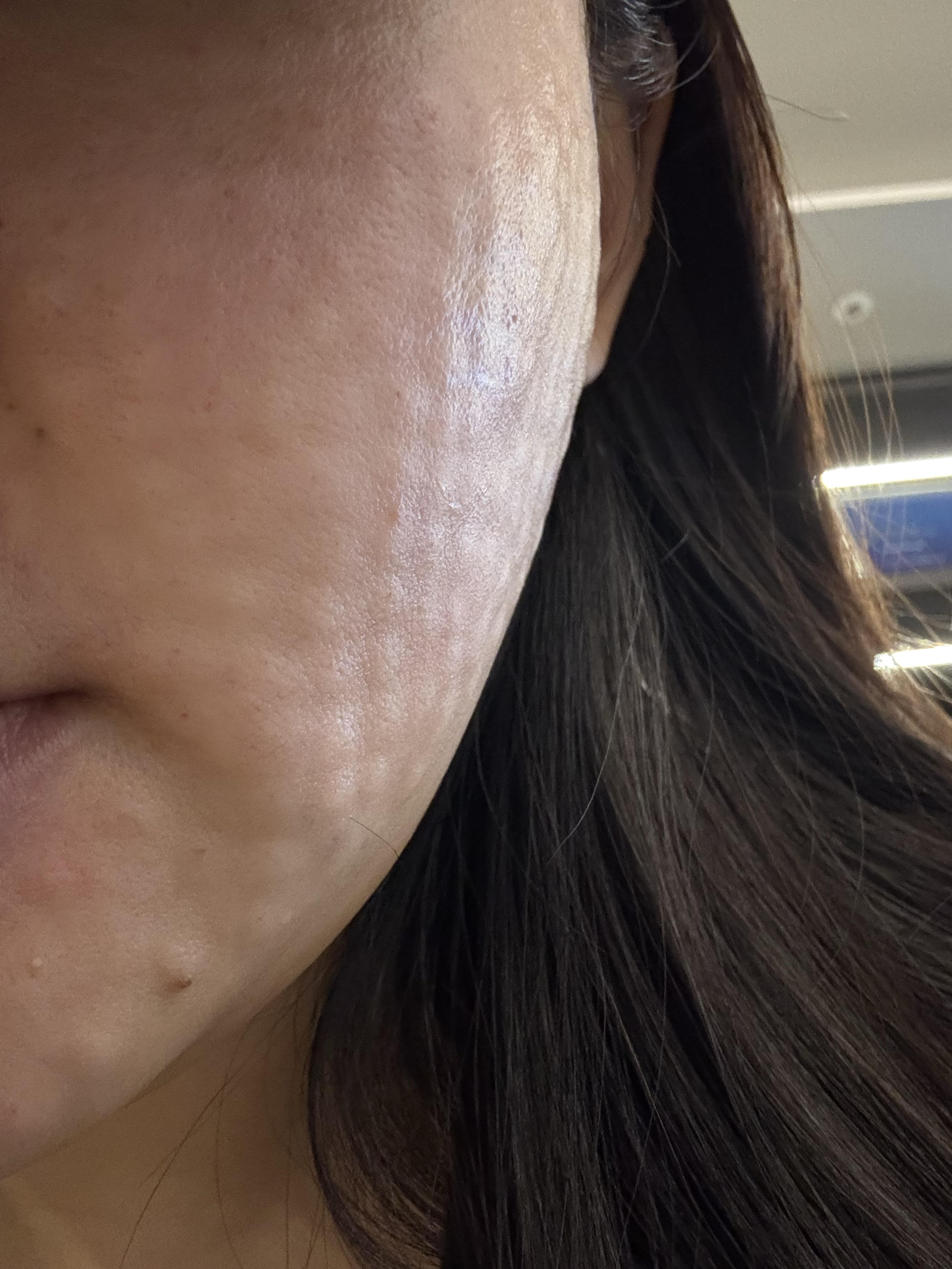 수술후기이미지