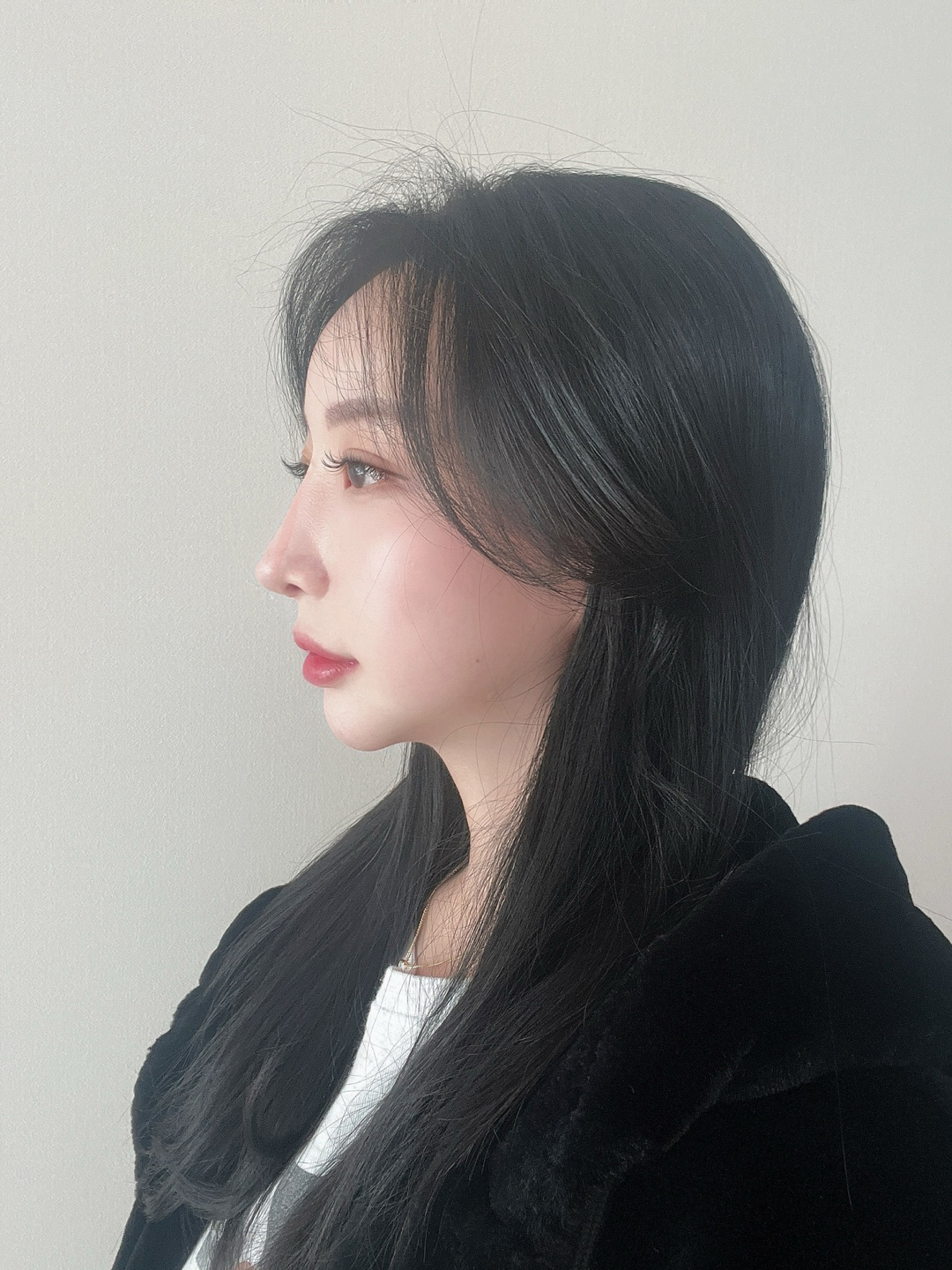 수술후기이미지