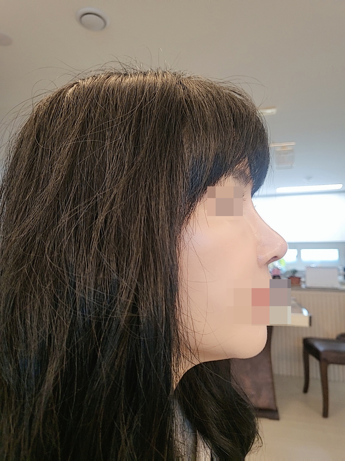 수술후기이미지