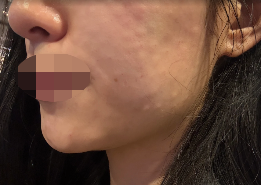수술후기이미지