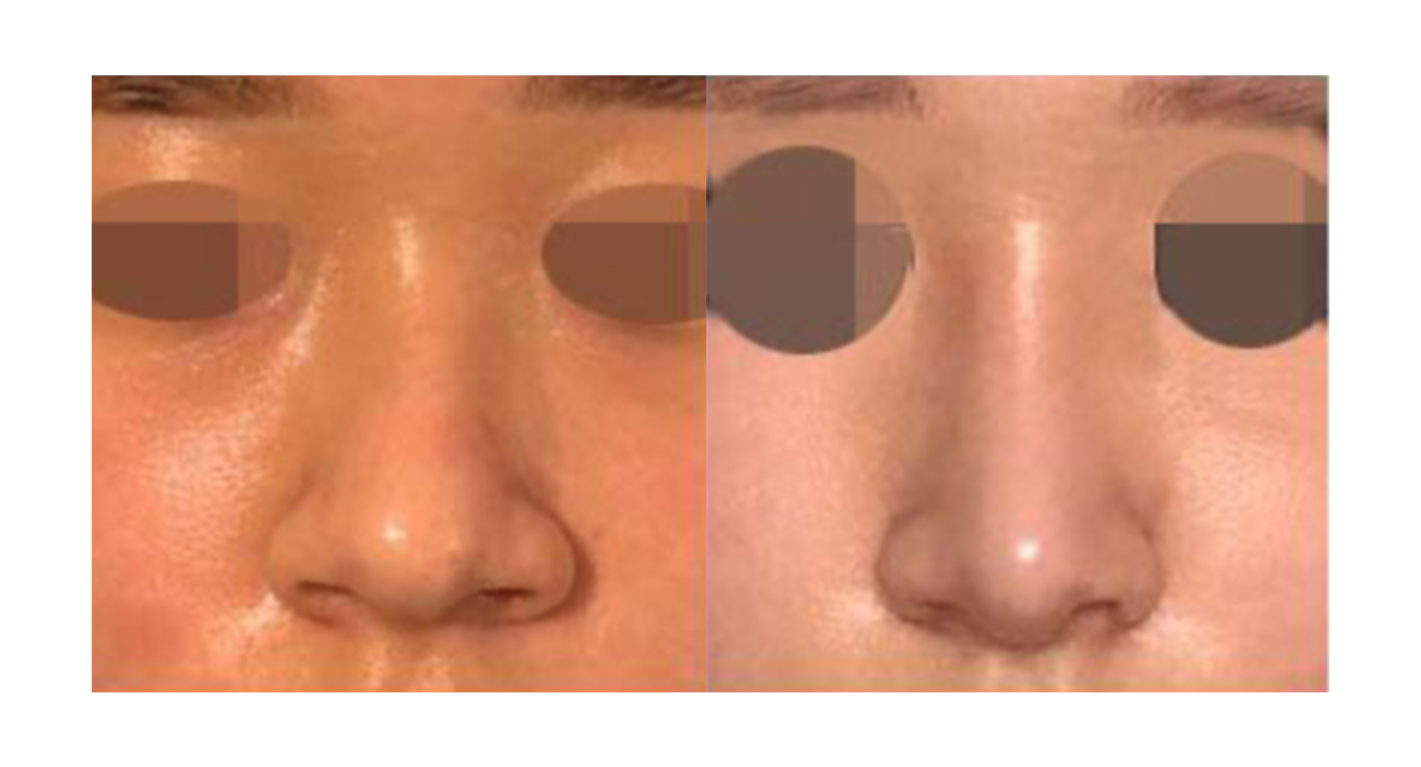 수술후기이미지